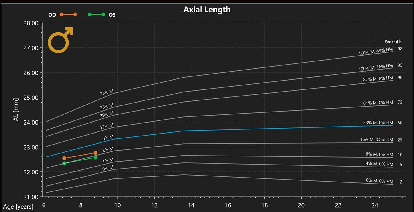 Graph showing axial length measurements
